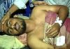 ফেনীতে এবার কলেজছাত্রকে পুড়িয়ে মারার চেষ্টা