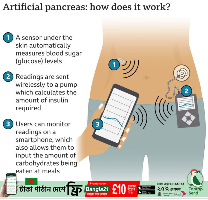 artificial_pancreas copy